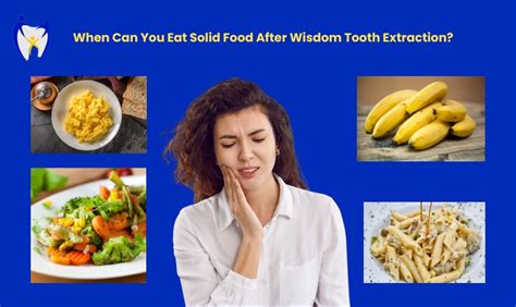 When Can You Eat Solid Food After Wisdom Tooth Extraction: A Journey Through Time and Taste Buds